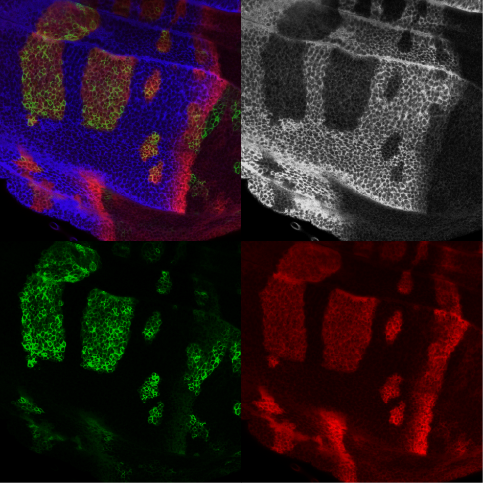 Drosophila Wing Discs