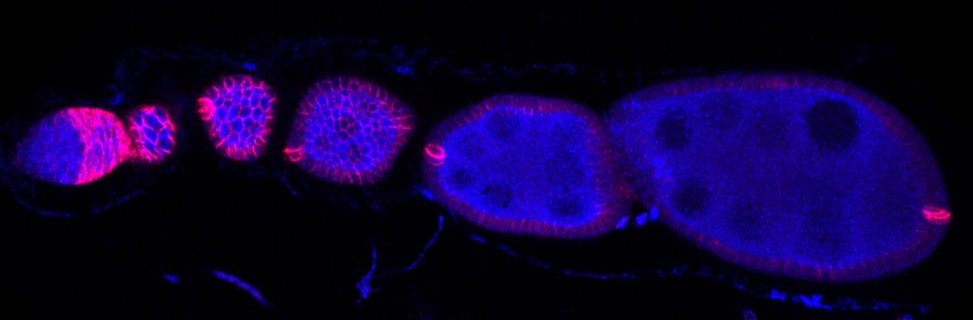 A Drosophila ovariole A confocal image of a typical Drosophila ovariole