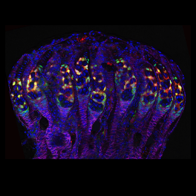 Adult Stem Cell Research