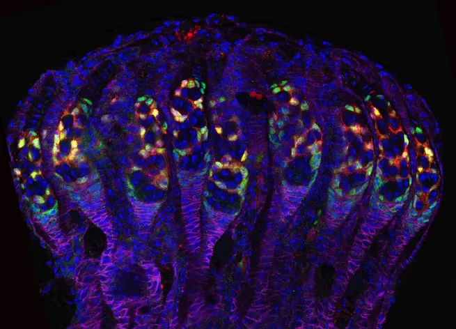 Drosophila Ovarioles